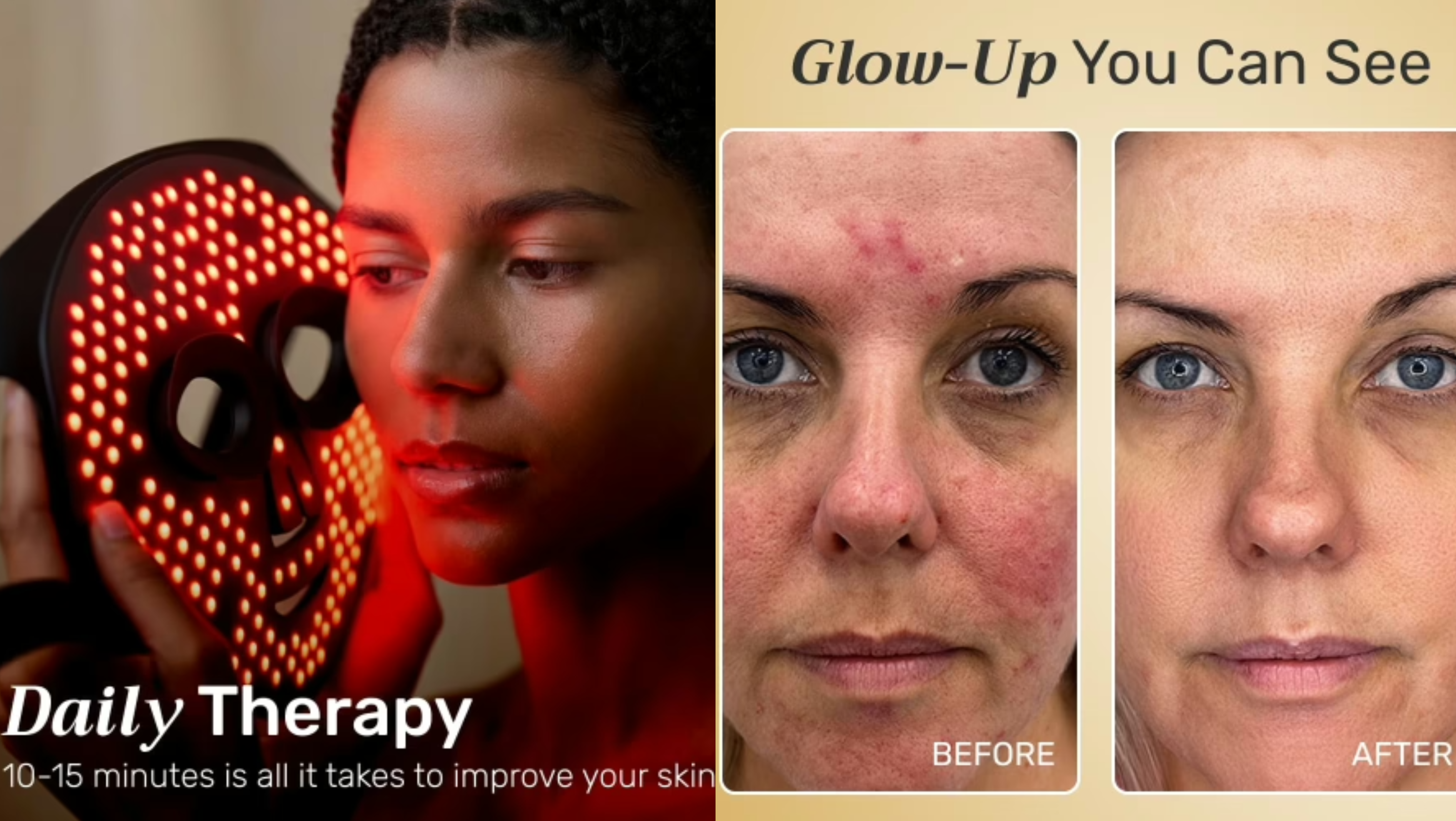 showing benefit of NuroDerma LED Light Mask